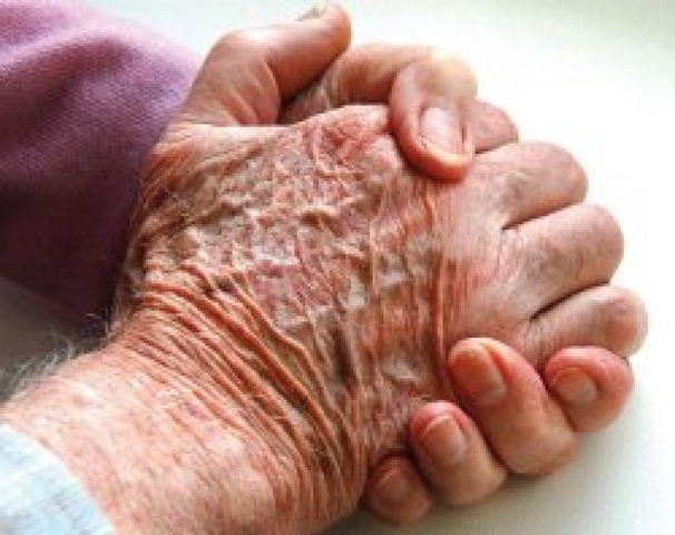 Avviso pubblico per il servizio di assistenza domiciliare diretta in favore di malati di Alzheimer residenti nell'ambito territoriale RM H (ora RM 6)